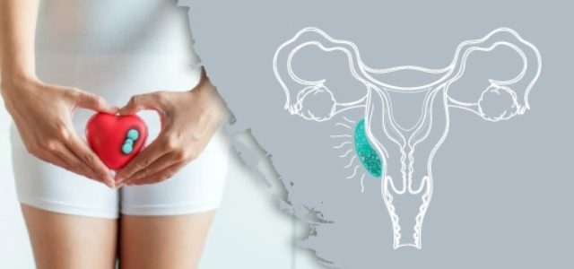 vulvar intraepitelyal neoplazi tedavi ücretleri